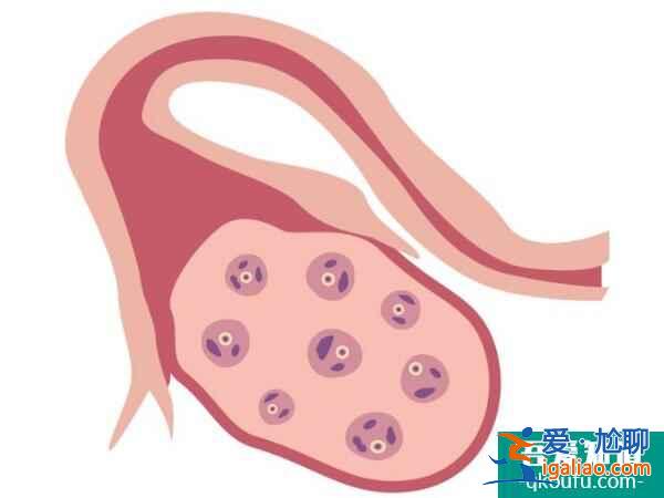 探秘去做试管婴儿蕴含的四大优势? 探秘去做试管婴儿蕴含的四大优势?