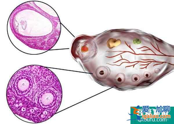 试管婴儿专家解密：是什么在消耗了您的卵巢寿命？？