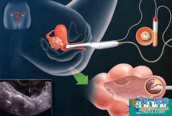 输卵管堵塞影响去做试管婴儿吗？？