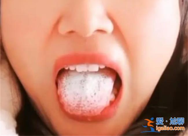 女子阳后舌头长满厚白舌苔，，好像涂了白白的东西[厚白舌苔]？