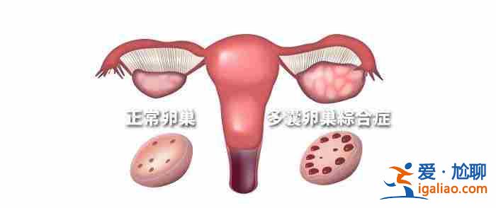 应聘代生妈妈〖听说很贵〗？