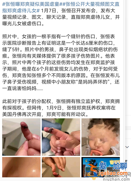 张恒指控郑爽虐童!孩子手指撕裂缝数针 视频曝光孩子语出惊人