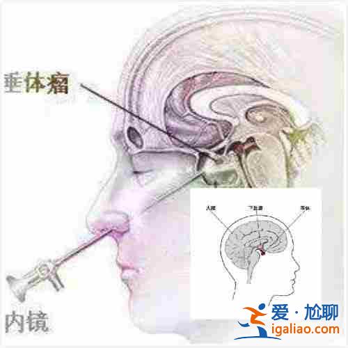 点击查询:给别人生孩子?欢迎您的加入？