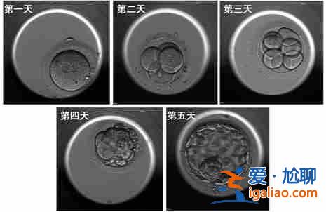 今日〖第三代试管婴儿成功率高吗〗高龄助孕吕进峰生子助孕公司？