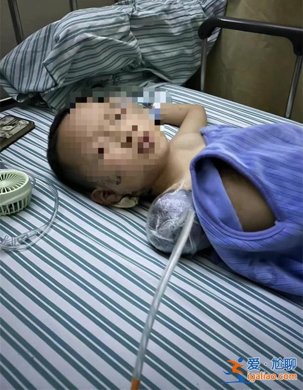 7岁的男童被邻居扔偏炮仗中致右臂受伤截止 两家有亲戚关系？