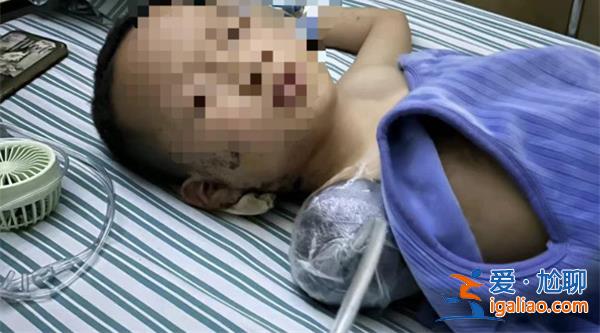 7岁男童被炮仗扎伤手臂截止，当地警方已经展开调查[警方]？