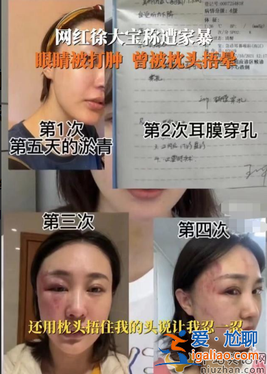 女星徐大宝要做混血试管儿 曾因家暴离婚不相信爱情 网友在线劝阻扎心了