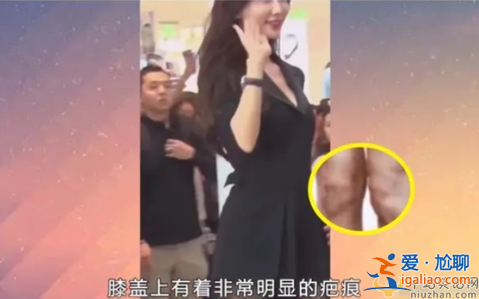 林志玲家暴是真的么为什么被家暴？生图曝光惨不忍睹满脸痘印皱纹明显