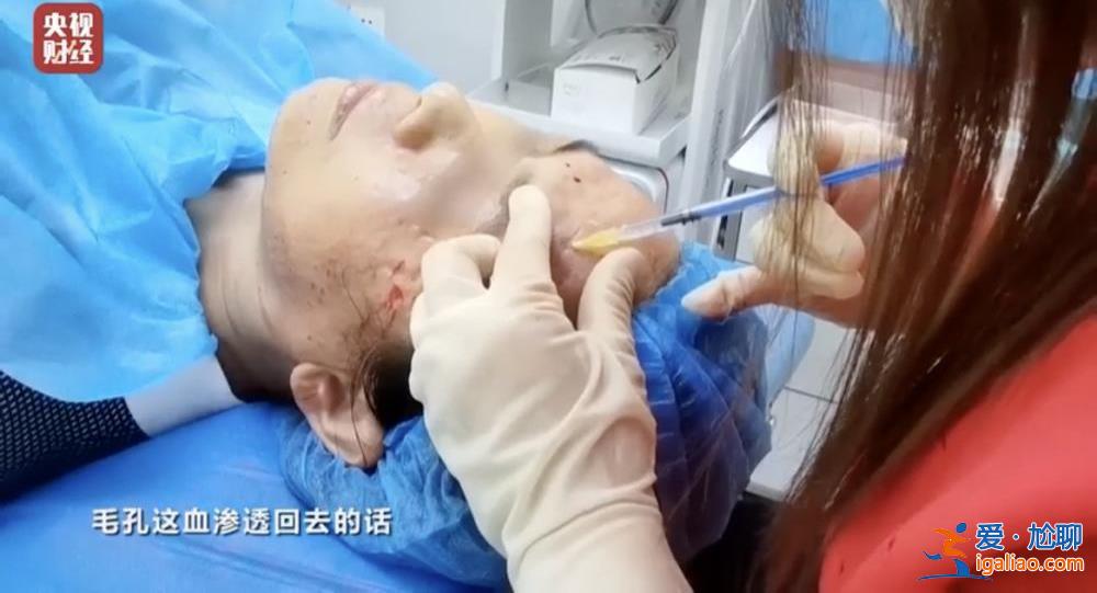 曝光不可注射的美容针！妆字号美容针或致毁容？