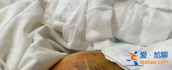 6次手术花上百万元 现在还躺在医院？