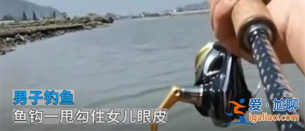 男子钓鱼不慎将鱼钩甩到5岁女儿眼皮上[不慎]？