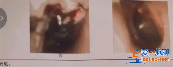 3岁娃疑被老师掌掴致听力受损，幼儿园老师应以身作则[以身作则]？