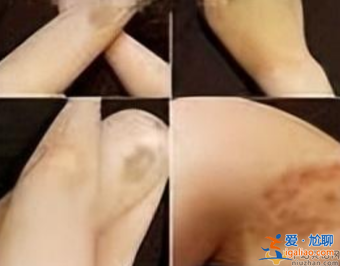 网红蔡瑛纹被男友家暴致流产，控诉男方吃软饭还劈腿