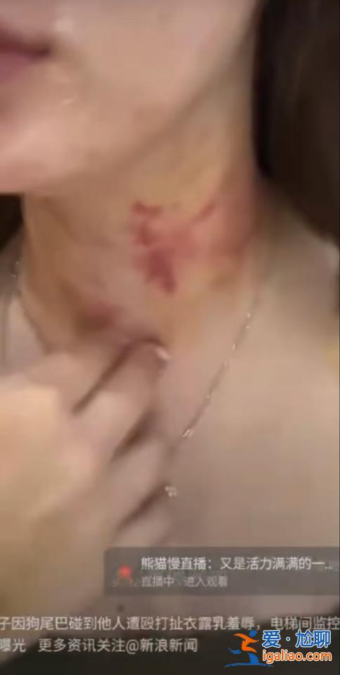 牵狗进电梯与邻居发生纠纷 女子发多条视频称遭殴打羞辱？