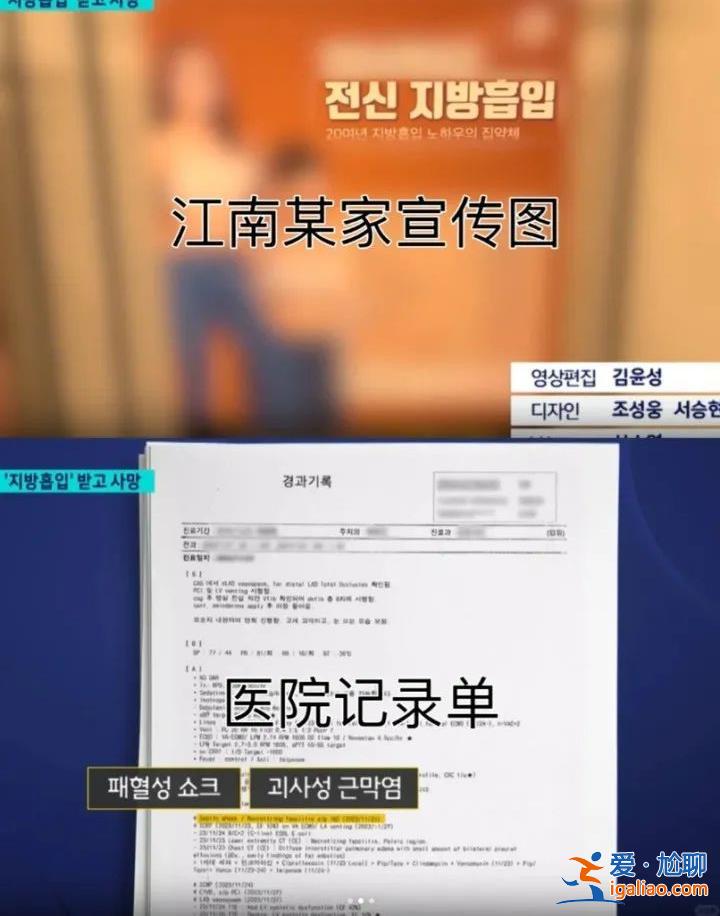 赴韩整形两周内三次抽脂 20多岁中国女孩不幸身亡 韩国警方计划尸检？