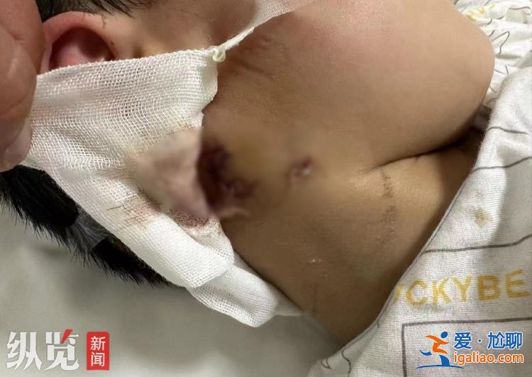 只希望尽快找到狗主人？