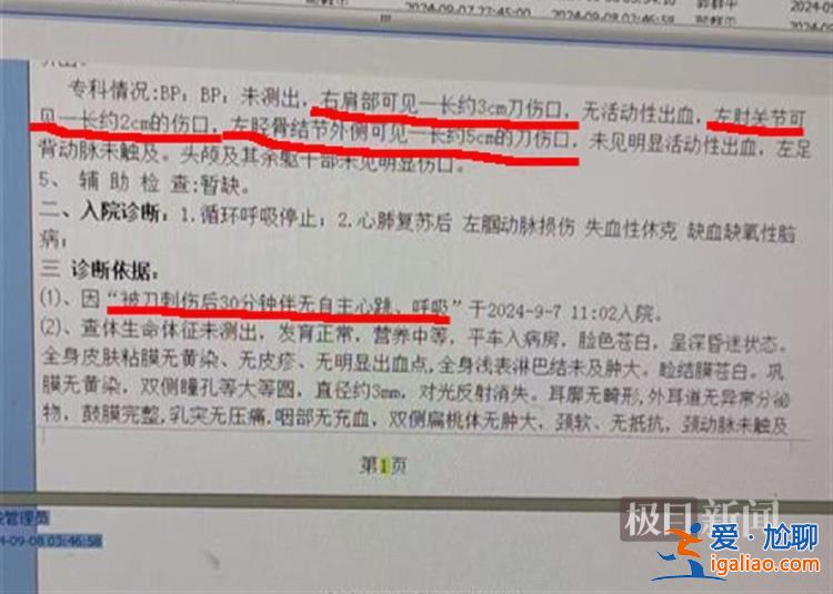 抢救8天后离世？