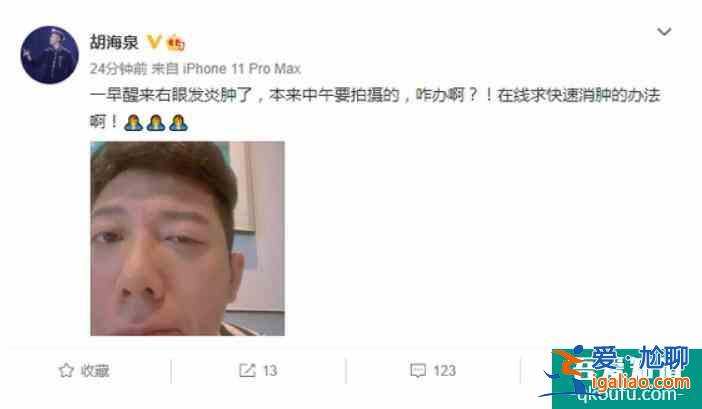 胡海泉右眼发炎红肿 吃力半睁右眼尽显疲惫十足？